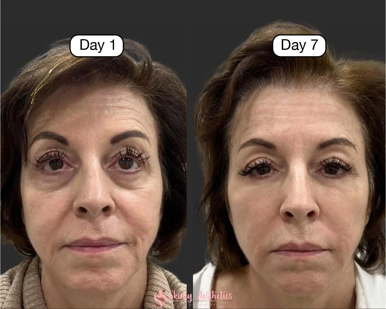 Facial Contour Brush