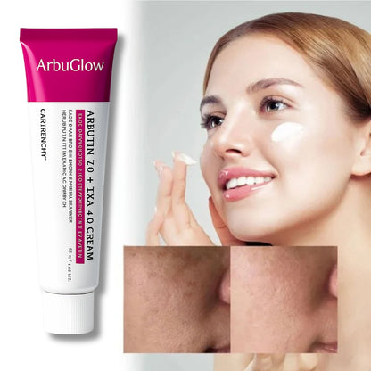 ArbuGlow - Dark Spot Correcting Cream